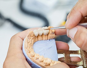 Lab technician creating a fixed dental bridge